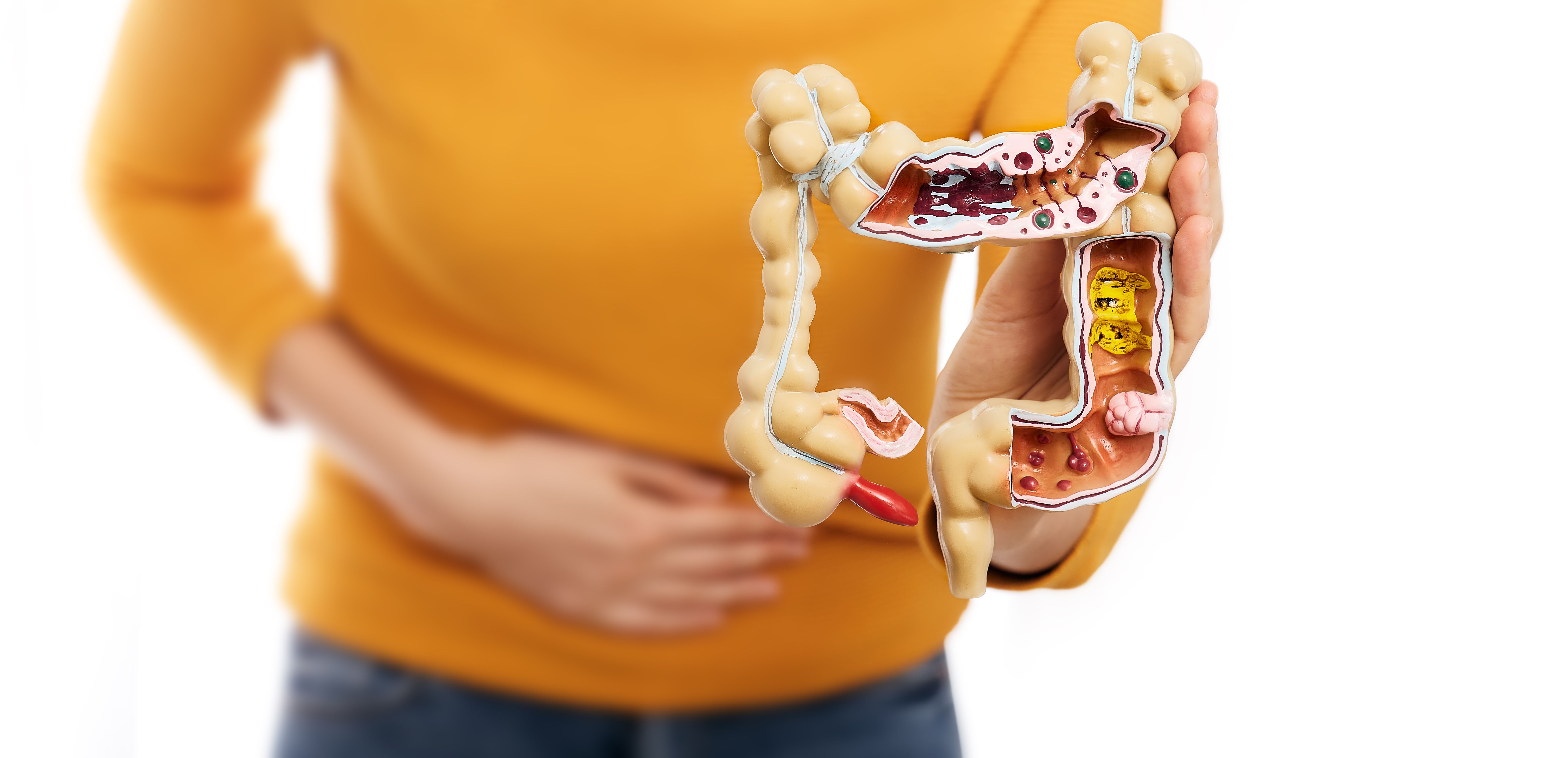 Pessoa vestida com blusa amarela segurando um modelo anatômico do intestino grosso. 